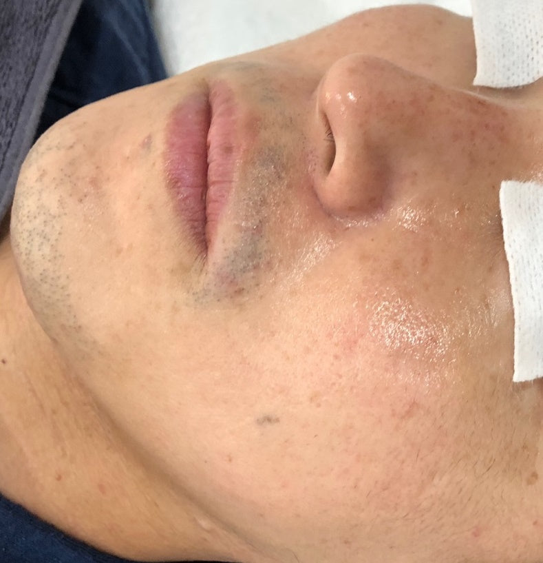 ラションブ　ラブレションキット　正規品 LABURESSON KIT – La ChomB JAPAN