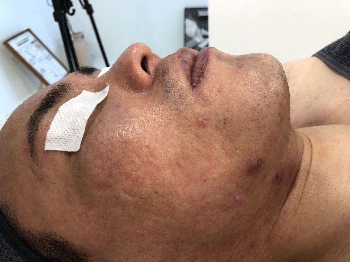 LABURESSON KIT – La ChomB JAPAN